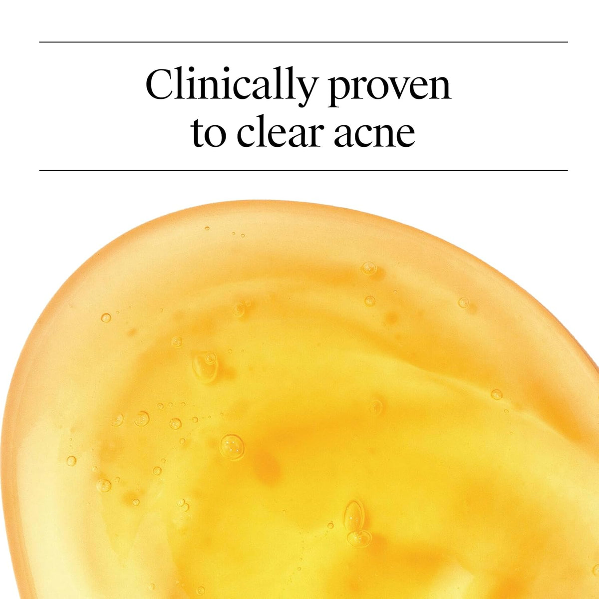 Oil Free Acne Face Wash, 9.1 Fl. Oz