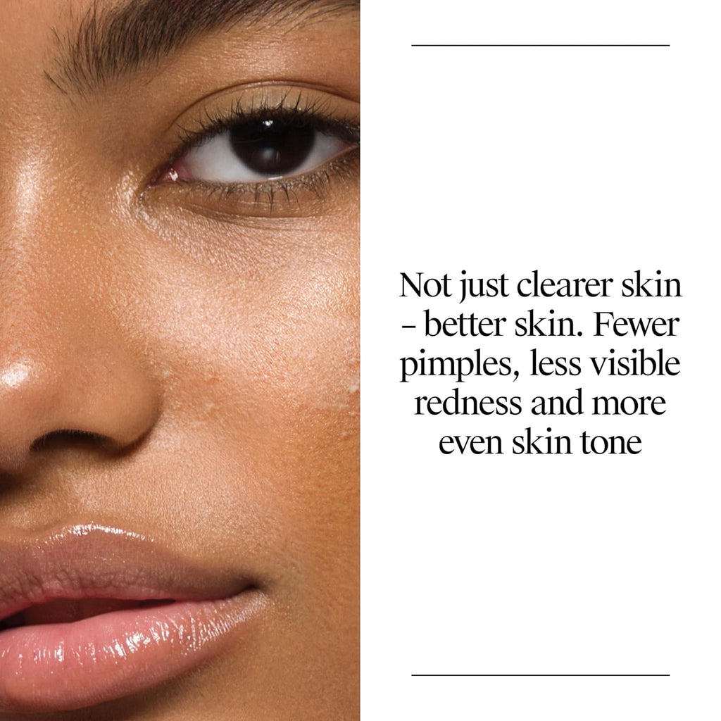Oil Free Acne Face Wash, 9.1 Fl. Oz