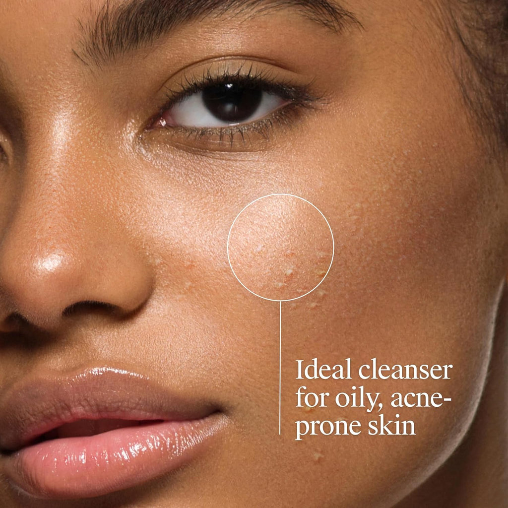 Oil Free Acne Face Wash, 6 Fl. Oz